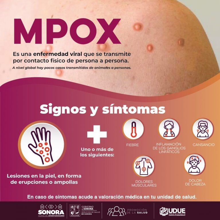 MPOX-1